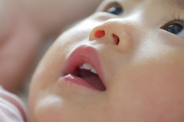 口呼吸が顎の発育に与える影響